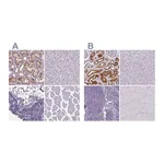 Atlas Antibodies Anti-ATP6V1D Antibody