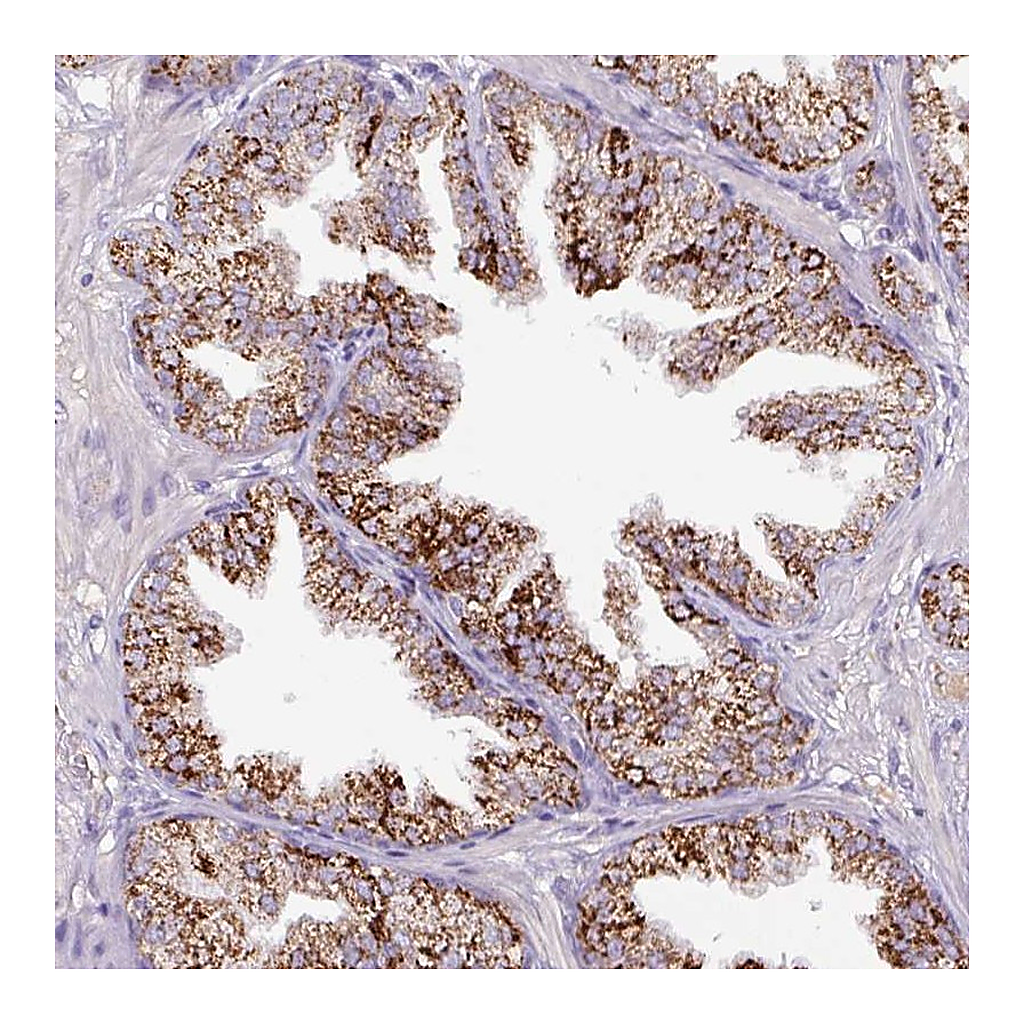Atlas Antibodies Anti-ATP6V1E2 Antibody