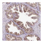 Atlas Antibodies Anti-ATP6V1E2 Antibody