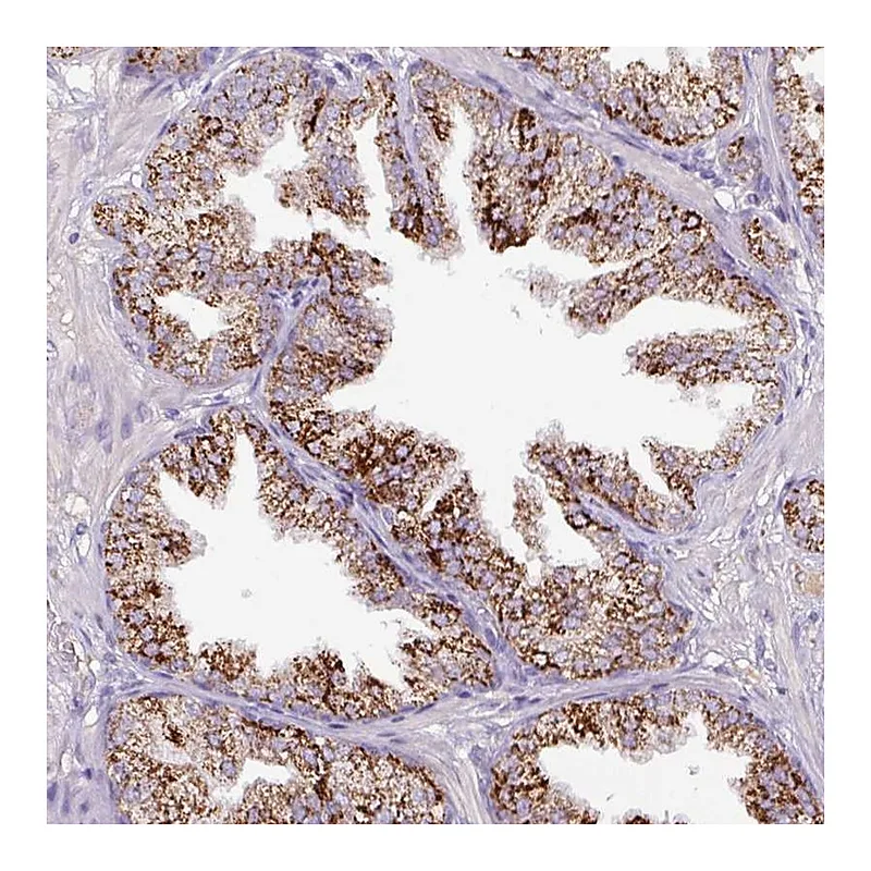 Atlas Antibodies Anti-ATP6V1E2 Antibody
