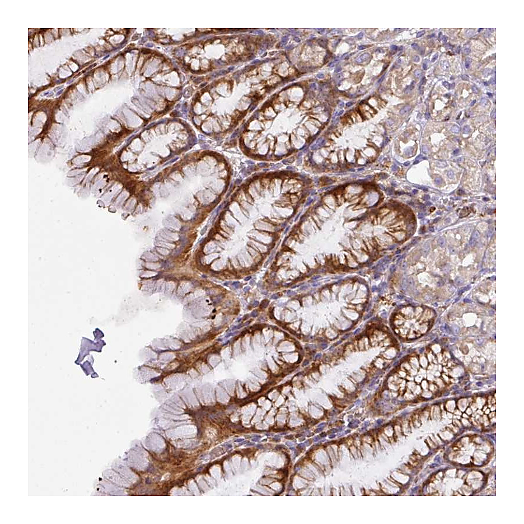 Atlas Antibodies Anti-ATP6V1F Antibody
