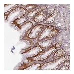 Atlas Antibodies Anti-ATP6V1F Antibody