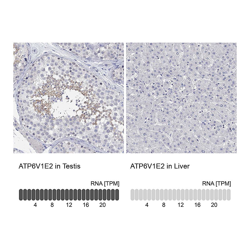 Atlas Antibodies Anti-ATP6V1E2 Antibody