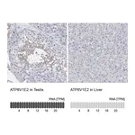 Atlas Antibodies Anti-ATP6V1E2 Antibody