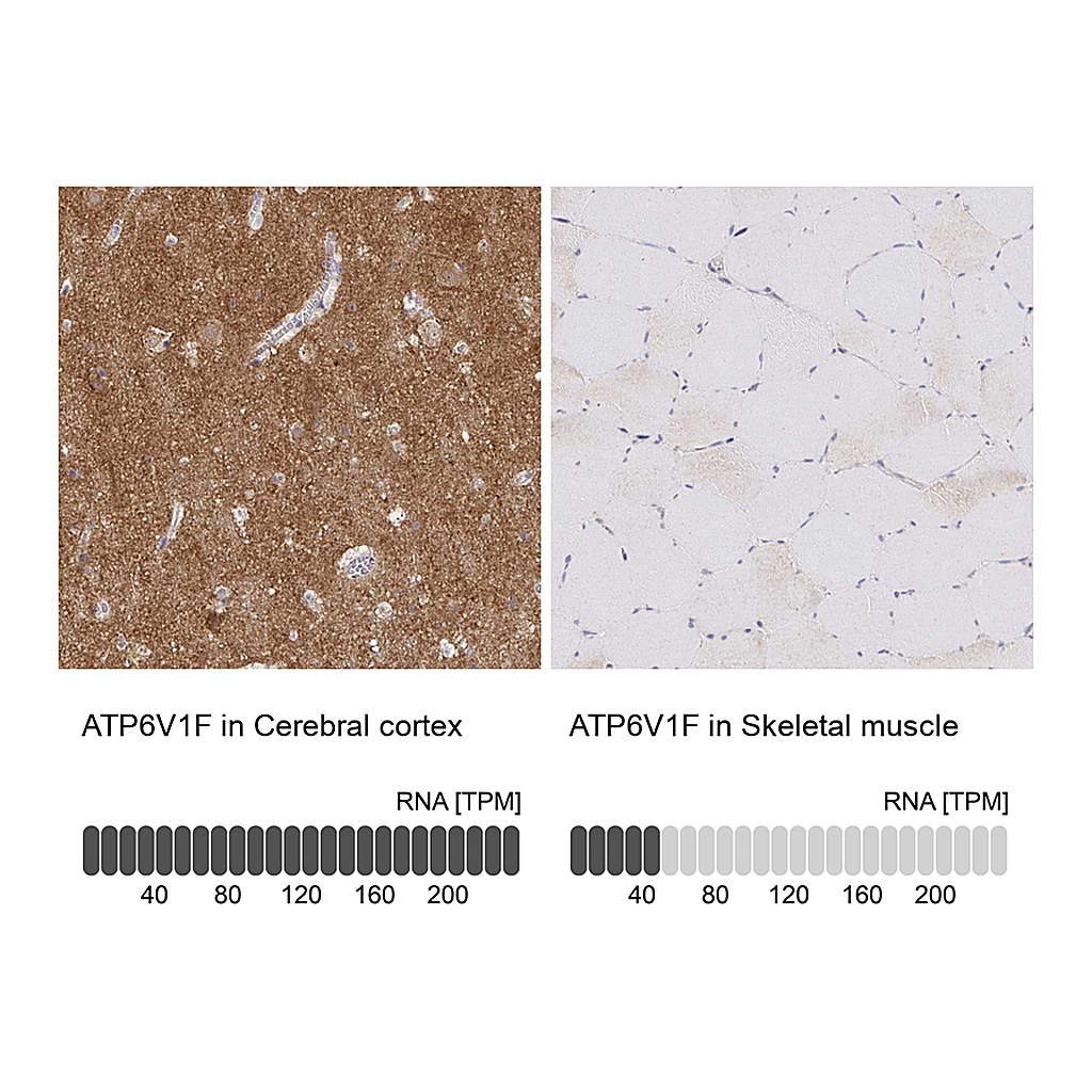 Atlas Antibodies Anti-ATP6V1F Antibody