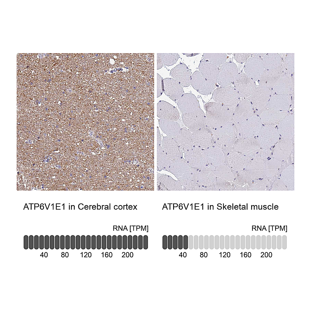 Atlas Antibodies Anti-ATP6V1E1 Antibody