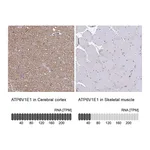 Atlas Antibodies Anti-ATP6V1E1 Antibody