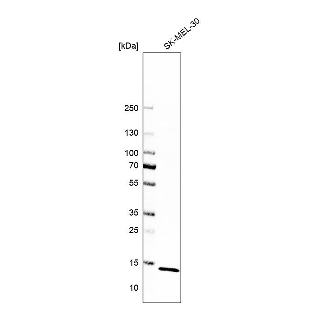 Atlas Antibodies Anti-ATP6V1G1 Antibody