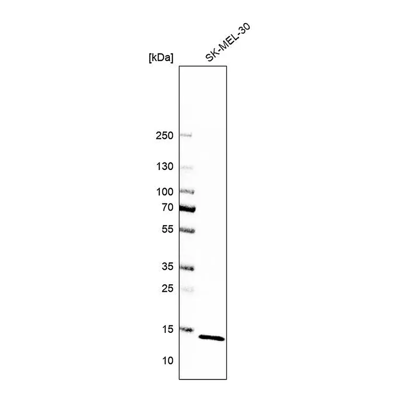 Atlas Antibodies Anti-ATP6V1G1 Antibody