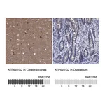 Atlas Antibodies Anti-ATP6V1G2 Antibody