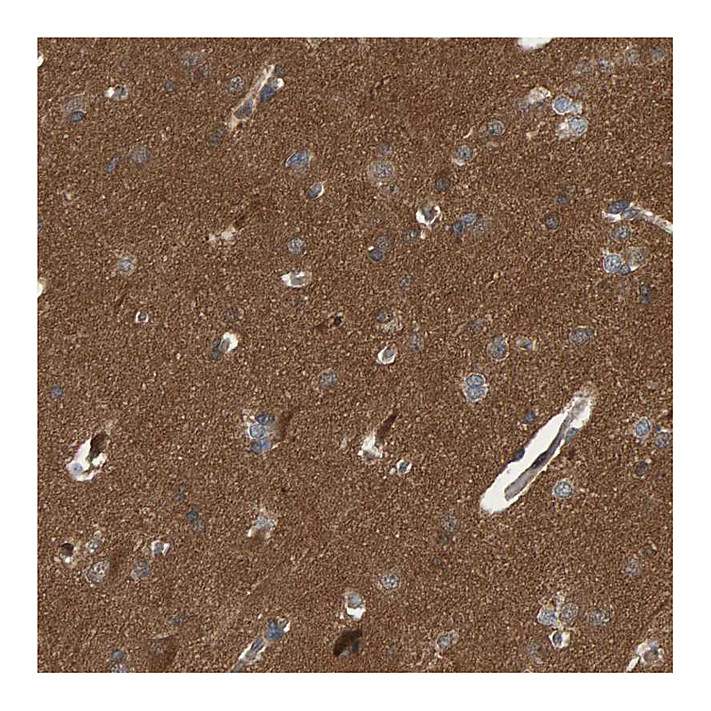 Atlas Antibodies Anti-ATP6V1H Antibody