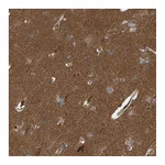 Atlas Antibodies Anti-ATP6V1H Antibody
