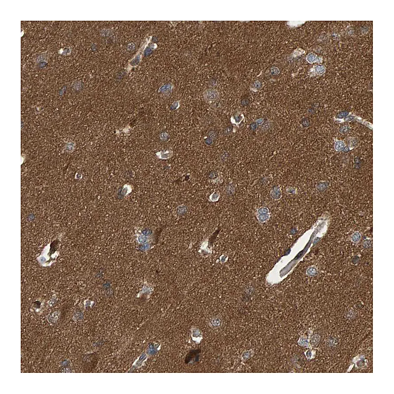 Atlas Antibodies Anti-ATP6V1H Antibody
