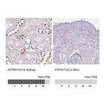 Atlas Antibodies Anti-ATP6V1G3 Antibody