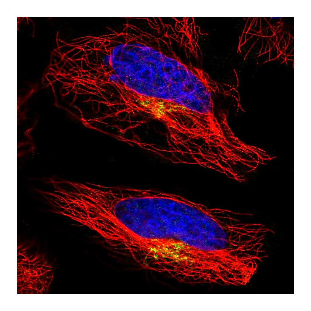 Atlas Antibodies Anti-ATP7A Antibody