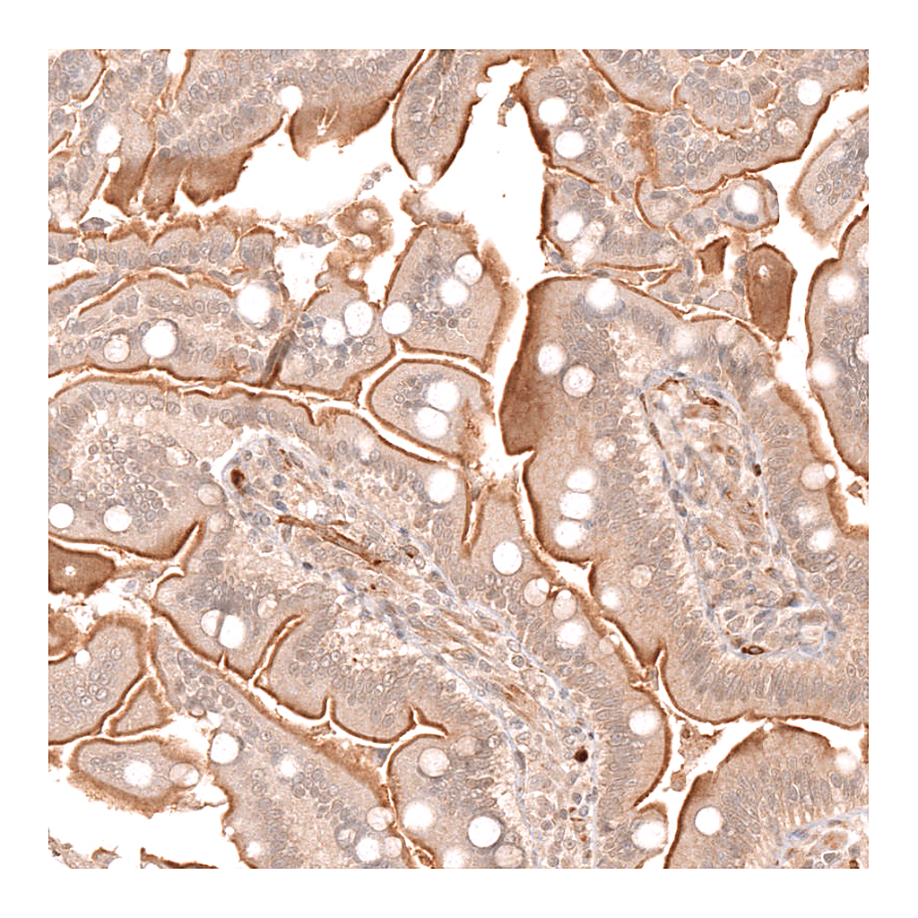 Atlas Antibodies Anti-ATP7A Antibody