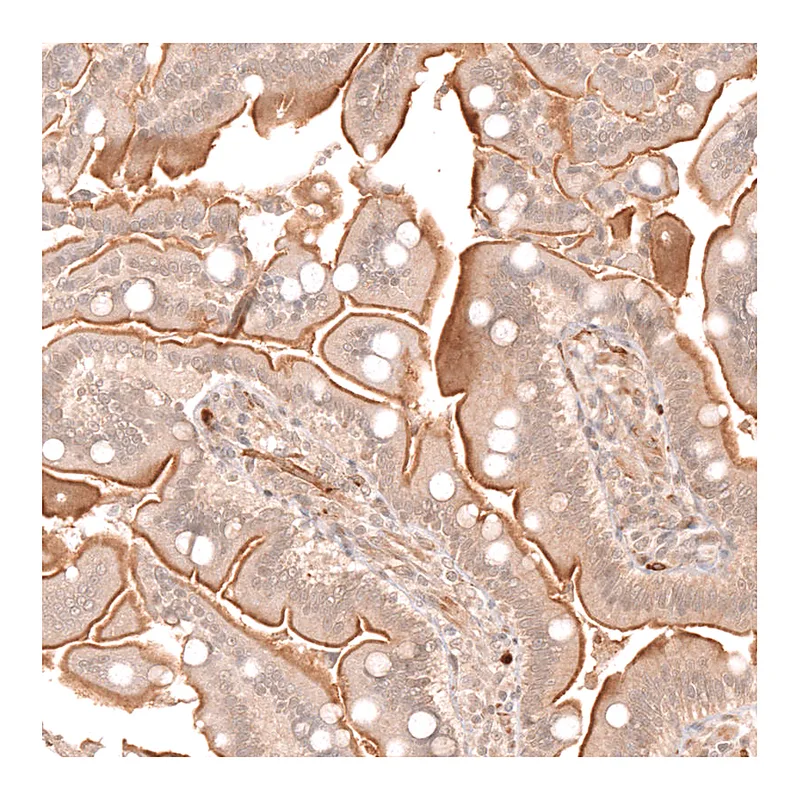 Atlas Antibodies Anti-ATP7A Antibody