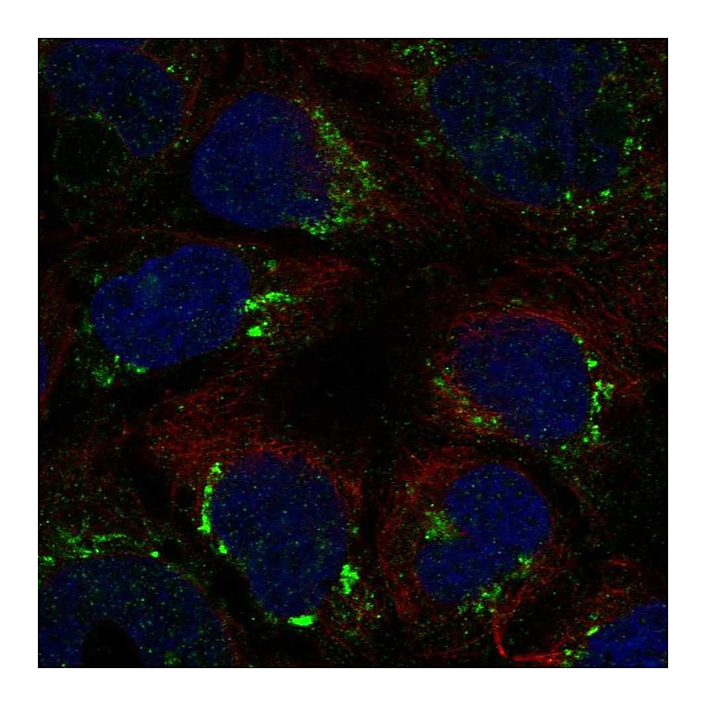 Atlas Antibodies Anti-ATP7B Antibody