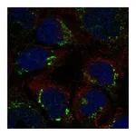 Atlas Antibodies Anti-ATP7B Antibody