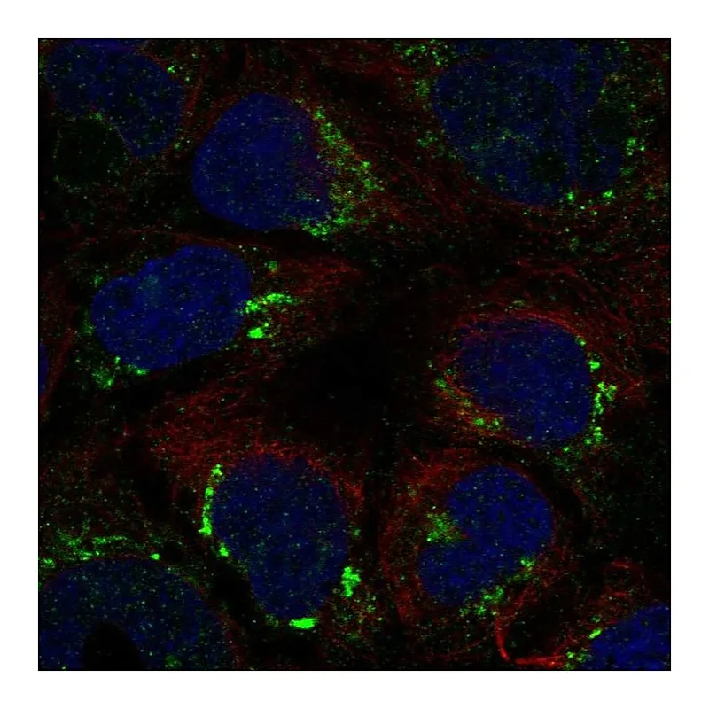 Atlas Antibodies Anti-ATP7B Antibody