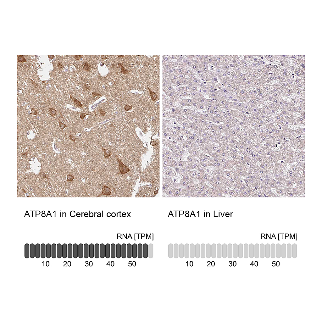 Atlas Antibodies Anti-ATP8A1 Antibody