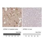 Atlas Antibodies Anti-ATP8A1 Antibody