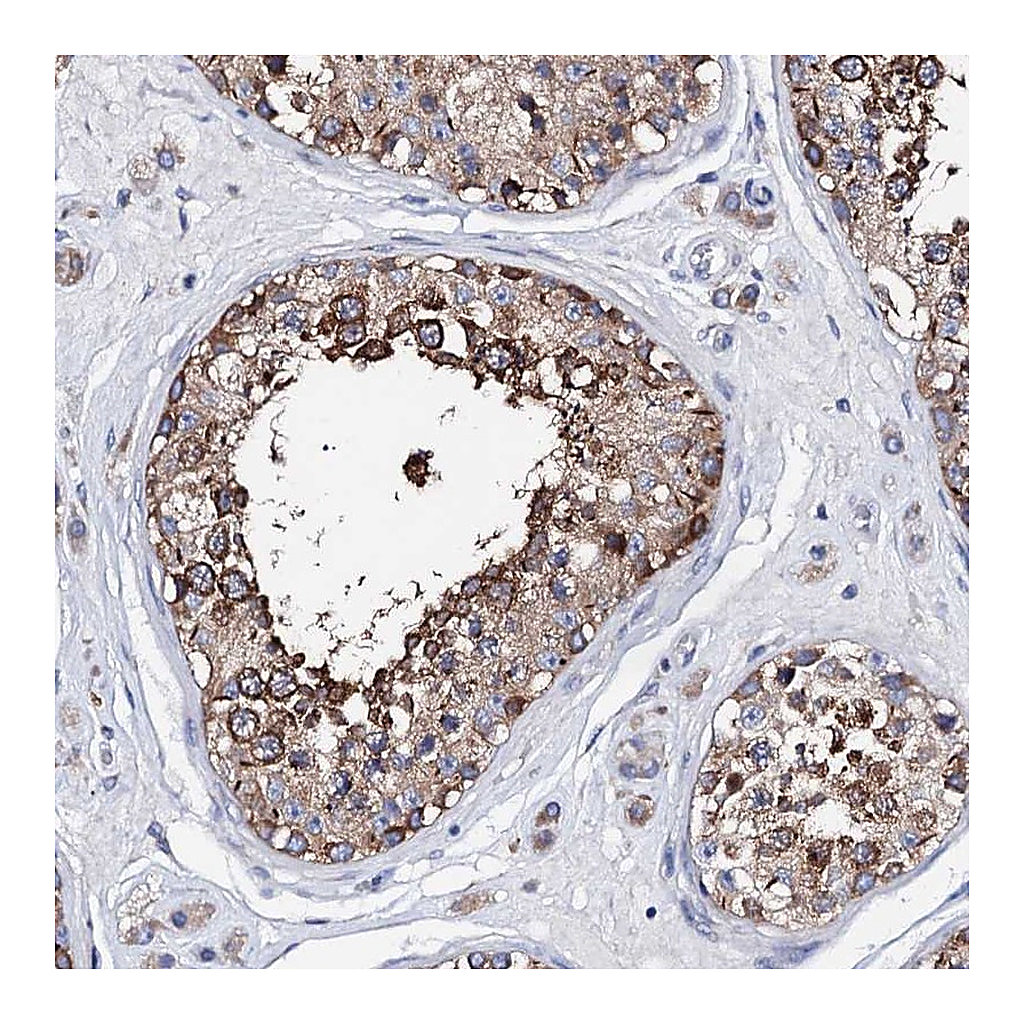 Atlas Antibodies Anti-ATP8A2 Antibody