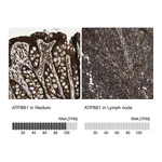 Atlas Antibodies Anti-ATP8B1 Antibody