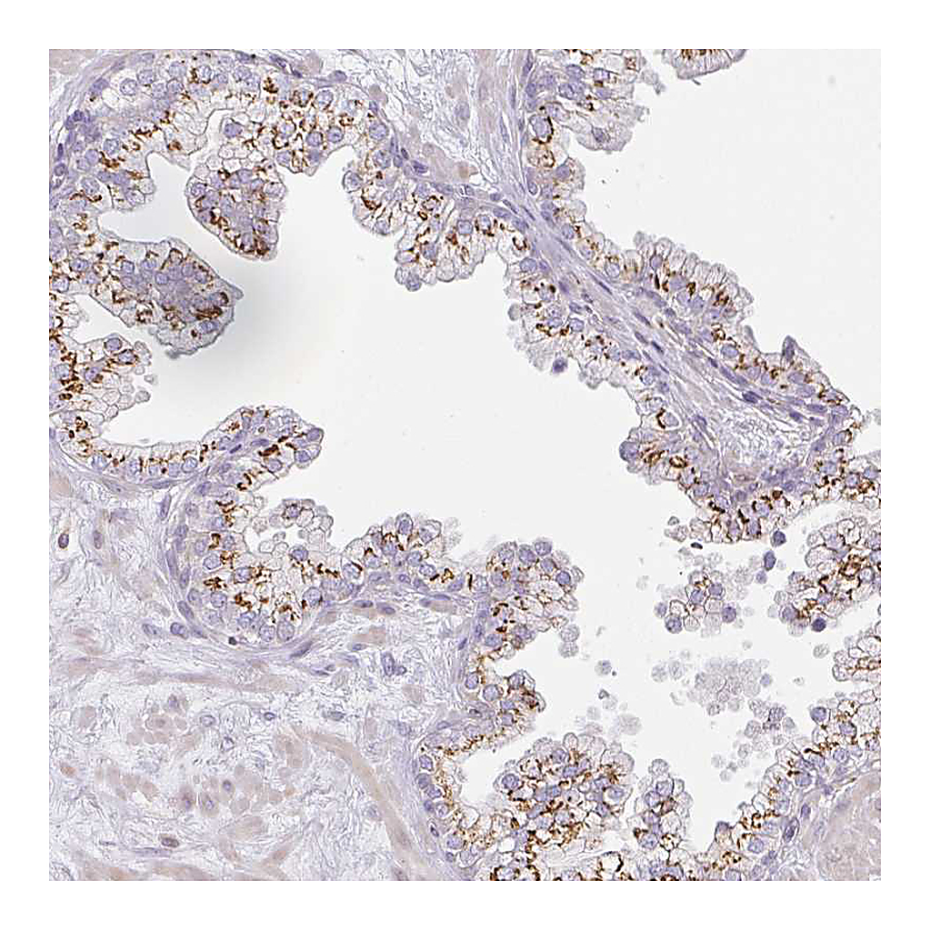 Atlas Antibodies Anti-ATP8B2 Antibody