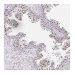 Atlas Antibodies Anti-ATP8B2 Antibody