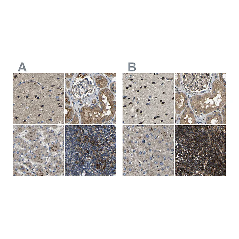 Atlas Antibodies Anti-ATP8B1 Antibody