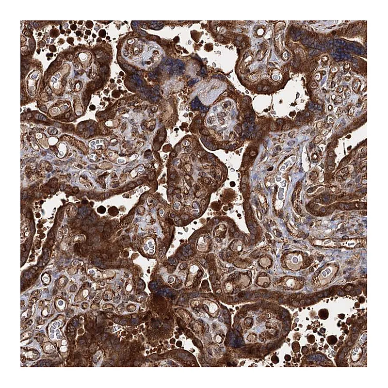 Atlas Antibodies Anti-ATP8B4 Antibody