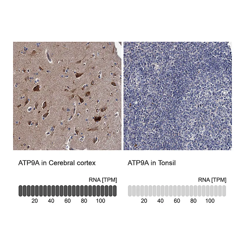 Atlas Antibodies Anti-ATP9A Antibody