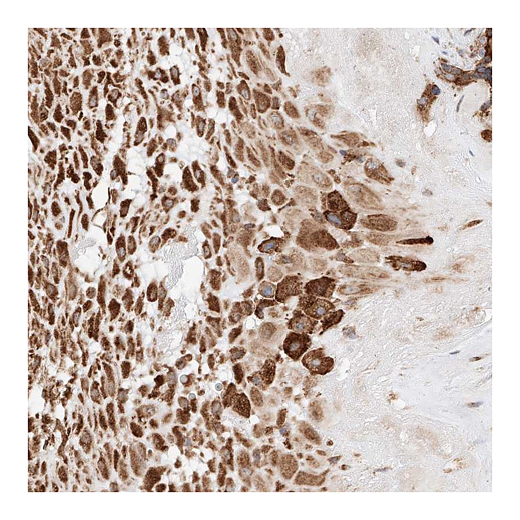 Atlas Antibodies Anti-ATP9B Antibody