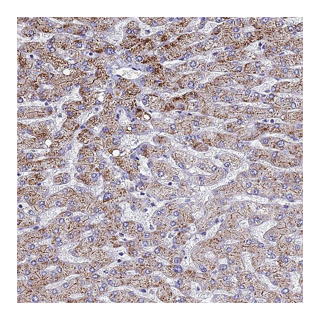 Atlas Antibodies Anti-ATPAF1 Antibody
