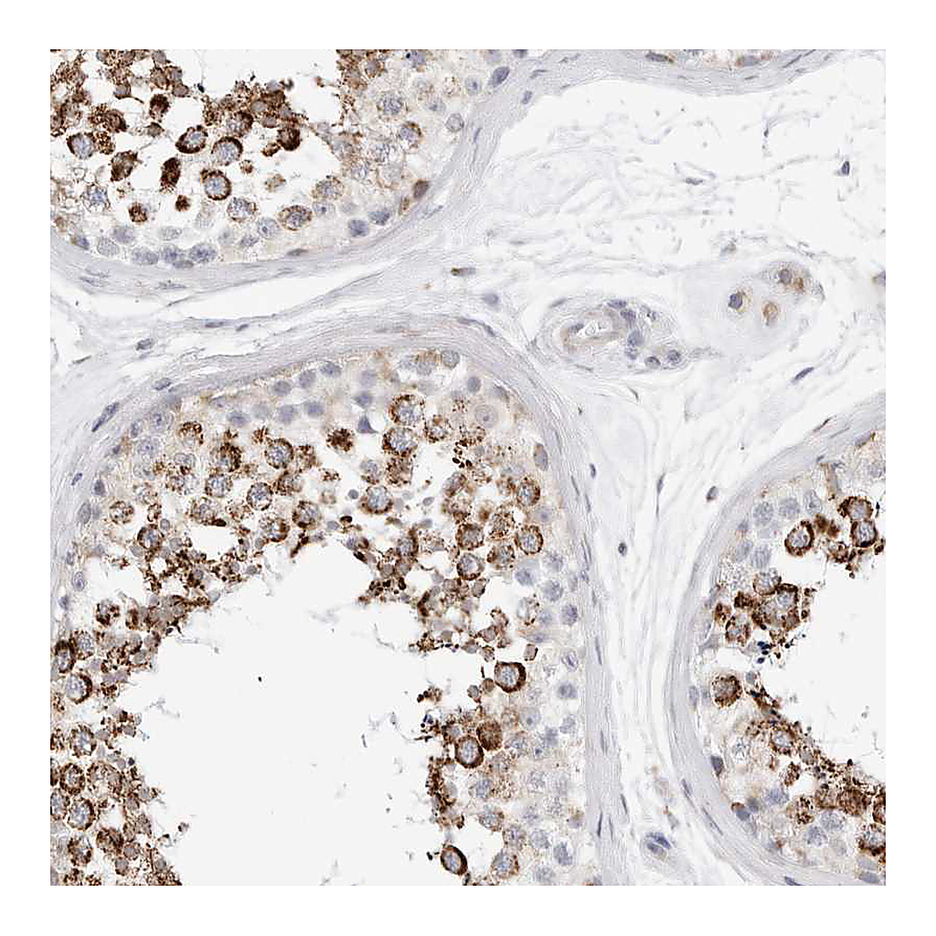 Atlas Antibodies Anti-ATPIF1 Antibody