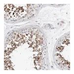 Atlas Antibodies Anti-ATPIF1 Antibody