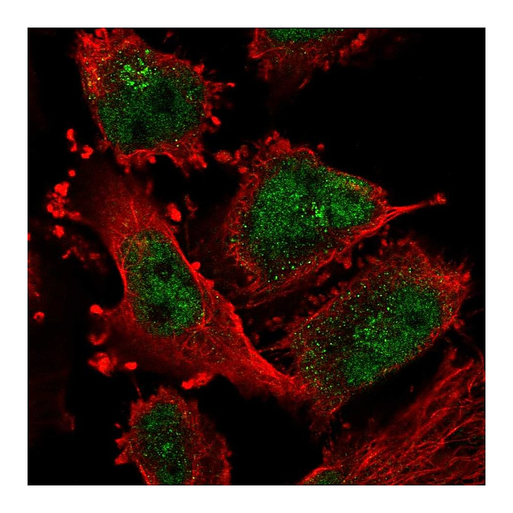 Atlas Antibodies Anti-ATR Antibody