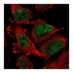Atlas Antibodies Anti-ATR Antibody