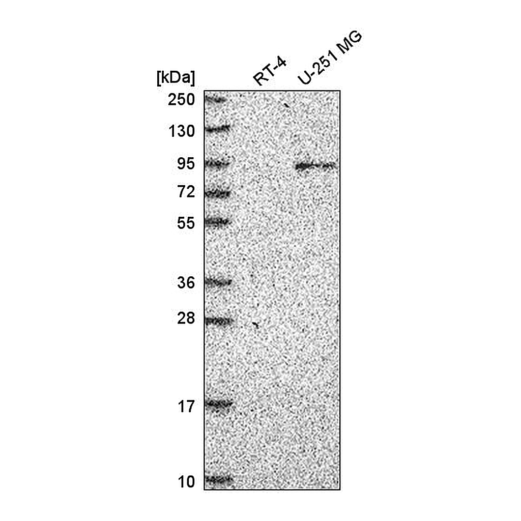 Atlas Antibodies Anti-ATRIP Antibody