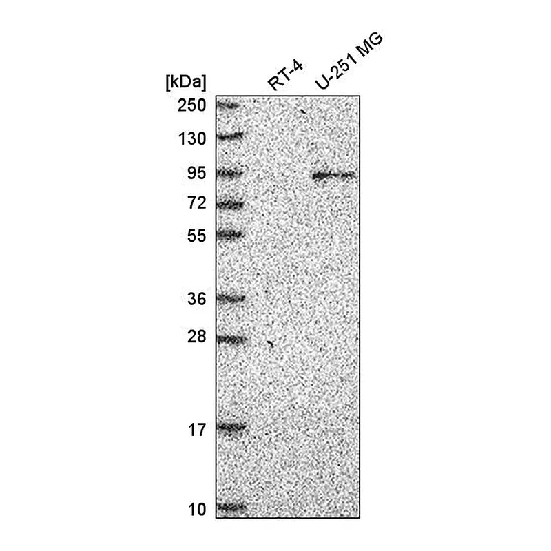 Atlas Antibodies Anti-ATRIP Antibody
