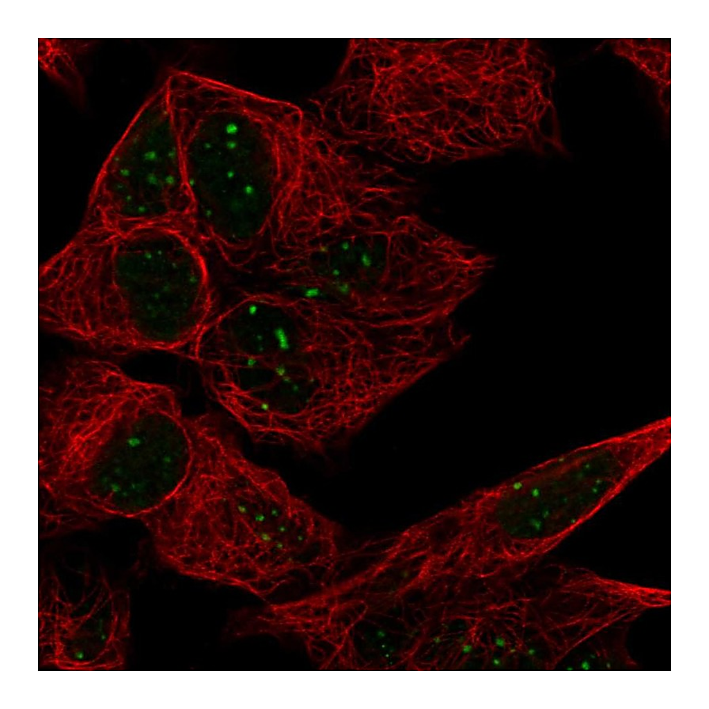 Atlas Antibodies Anti-ATRX Antibody
