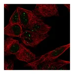Atlas Antibodies Anti-ATRX Antibody