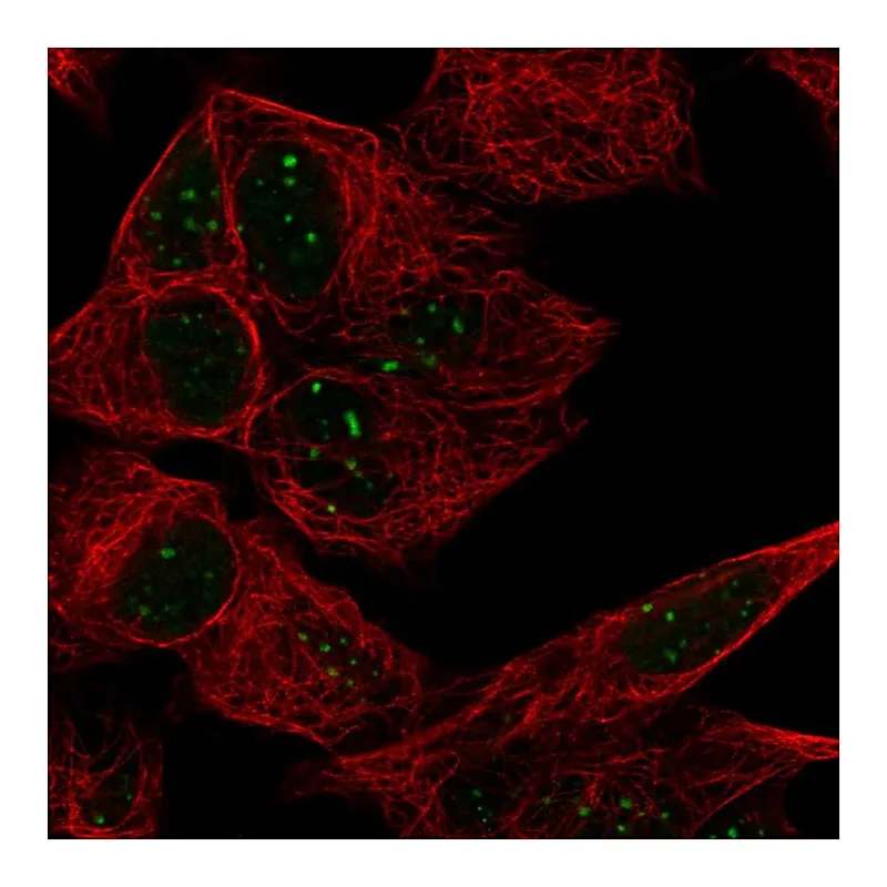 Atlas Antibodies Anti-ATRX Antibody