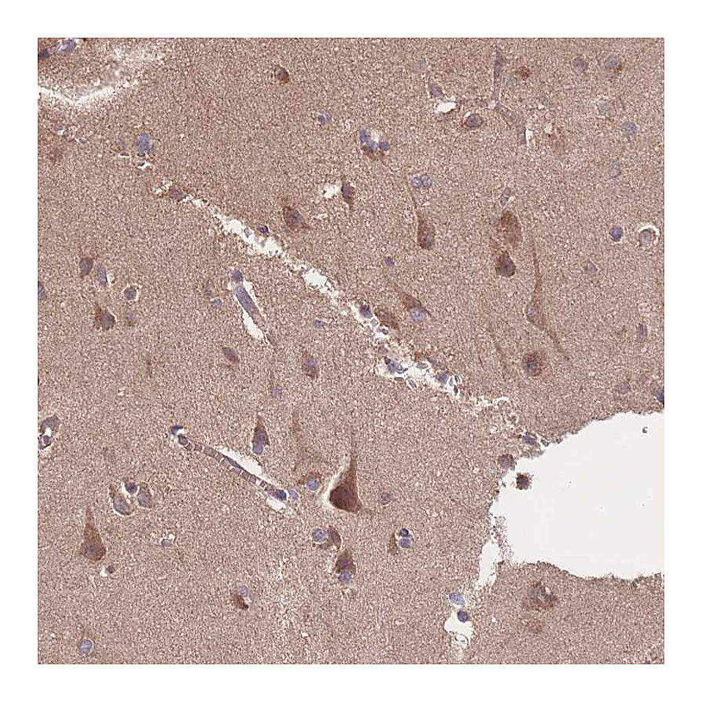 Atlas Antibodies Anti-ATXN10 Antibody