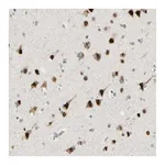 Atlas Antibodies Anti-ATXN1 Antibody