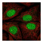 Atlas Antibodies Anti-ATXN1L Antibody