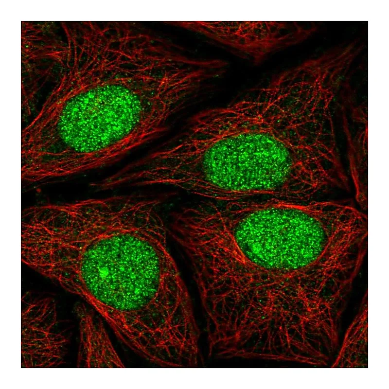 Atlas Antibodies Anti-ATXN1L Antibody