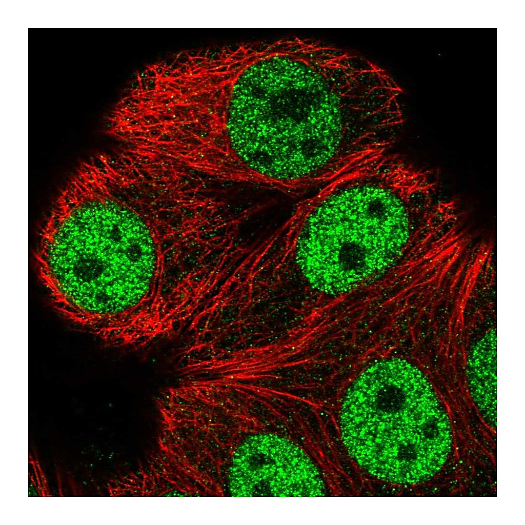Atlas Antibodies Anti-ATXN1L Antibody