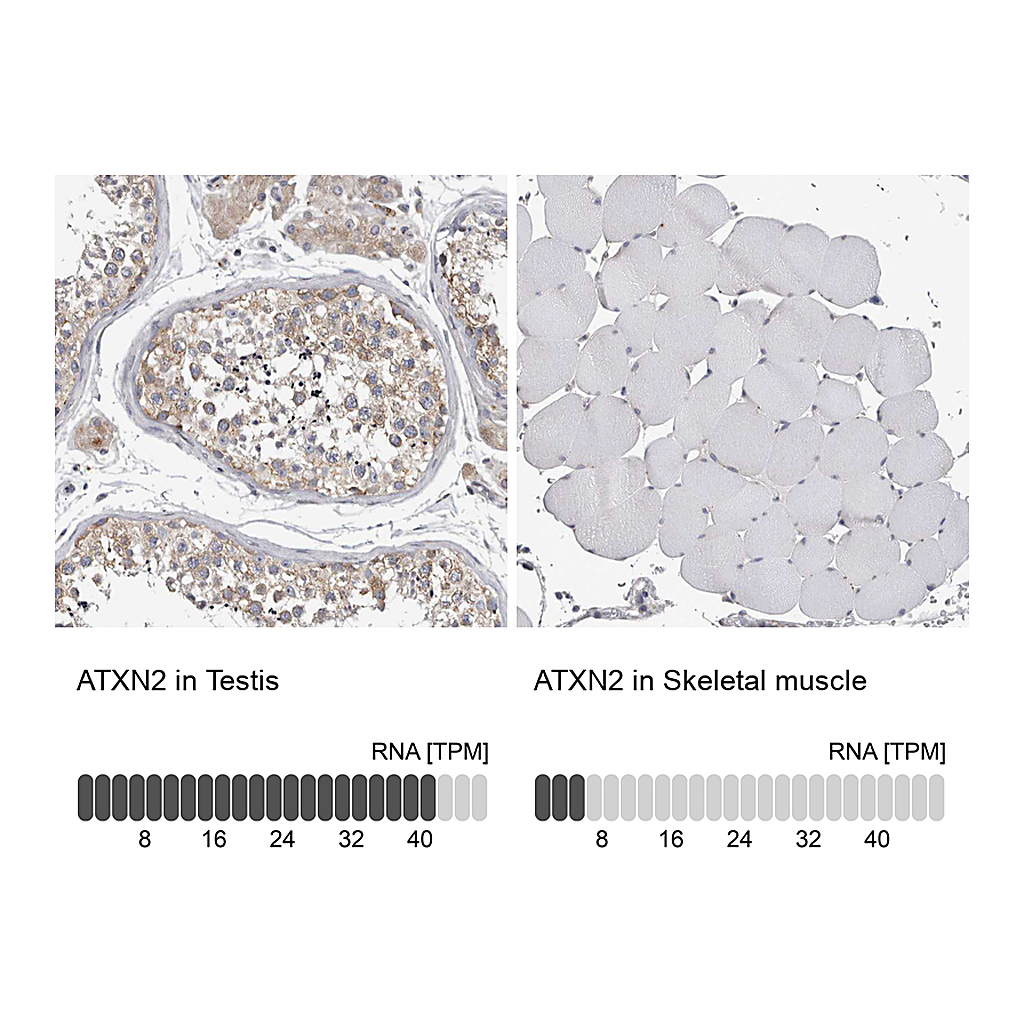 Atlas Antibodies Anti-ATXN2 Antibody